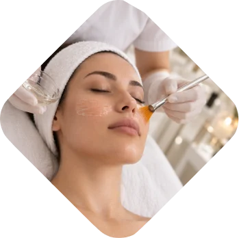 Chemical peel applied with a brush